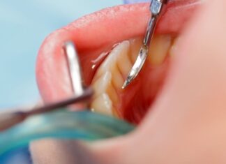 הכל על טיפולי שיניים מתקדמים